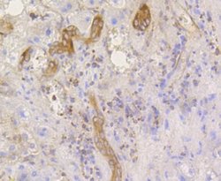 eIF2A, p Ser51 Antibody (SZ01-06), Novus Biologicals 100&mu;L:Antibodies,